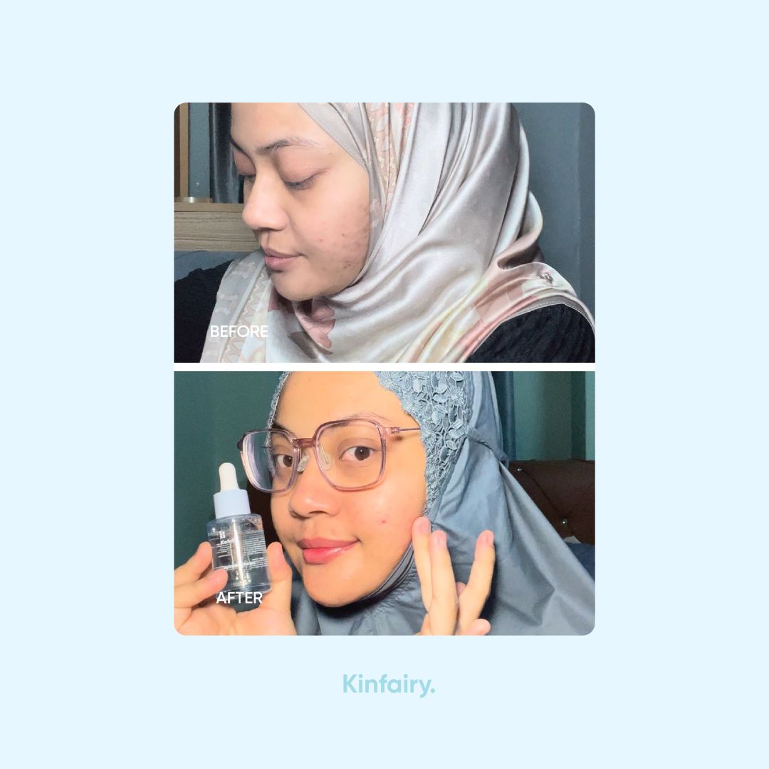 Hydrating Serum